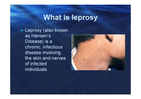 LEPROSY (hansen’s disease) -2