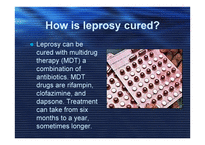 LEPROSY (hansen’s disease) -12