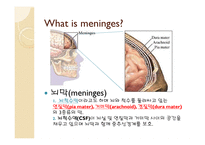 뇌수막염 Meningitis-3