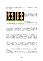 만성중이염 케이스스터디 간호진단3개,간호과정3개-4