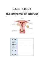 여성간호학(자궁) 간호과정 A+-1