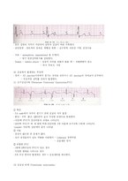 [심전도, 심장생리, 부정맥 간호, EKG] 심전도와 부정맥 간호-12