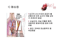 [운동과 건강] 심장질환-20