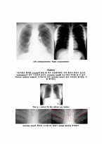 [PBL] Chest X-ray(흉부 X레이)-7