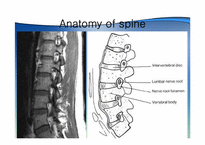 [한의학] spinal disorder(추간판탈출증과 척추관협착증을 중심으로)-5