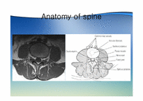 [한의학] spinal disorder(추간판탈출증과 척추관협착증을 중심으로)-6