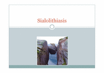 [이비인후과] 타석증(sialolithiasis)-1