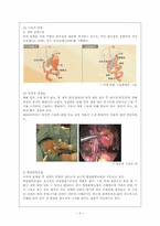 [의료복지사회사업론] About Stomach Ca-7