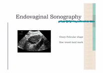 [의학과] 산부인과 정상 Sonography-8