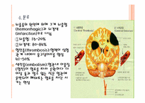 뇌졸중(Stroke) 레포트-13