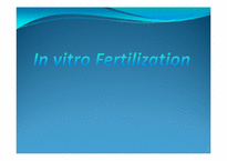 [발생공학] In vitro Fertilization-1