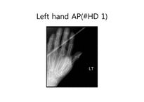 [의학] Case 분석-Left hand painful swelling-15