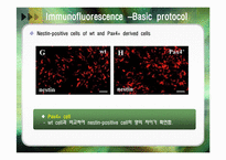 [세포생물학] Pax4 gene expression에 의한 Insulin 생성세포 분화촉진-18