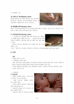 신생아 간호수기 실습내용<신생아체크리스트>-6