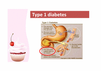 [약물학] 당뇨병(Diabetes)의 예방과 치료-9