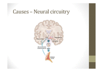 [생리심리] Neurobiology of Depression(영문)-13