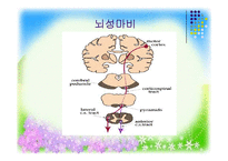 [사회복지] 뇌병변 장애의 판정과 극복-6