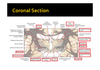 [해부학] 뇌의 관상단면(Coronal section)-10