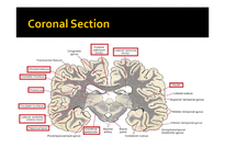 [해부학] 뇌의 관상단면(Coronal section)-13