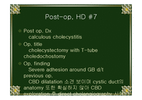 담낭염 cholecystitis 케이스-13