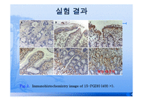 위암세포 15-PGDH 발현 연구-7