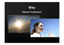 [광소재연구] Retinal Prosthesis-4