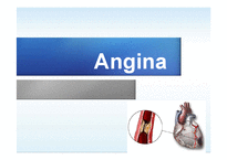 Angina, 협심증 간호진단-1