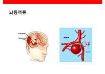 뇌심혈관질환의 이해 및 예방-7