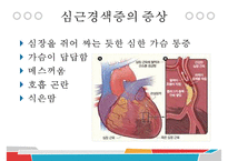 MI, 심근경색증, 간호과정, 심근경색증간호과정, SOAPIE, 관상동맥우회술, CABG, Miocardiac Infarction,-4