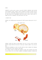 [뇌졸중] 뇌졸중의 종류와 증상, 뇌졸중 위험인자 및 예방, 뇌졸중의 진단과 치료방법(뇌졸중 약물요법, 수술요법, 운동요법, 식이요법)-2