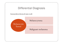 [의약] 악성 흑색종(malignant melanoma) 보존요법-15