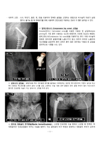 [A+] 성인간호학 실습,Fracture of base of neck of femur,케이스 스터디,대퇴골 경부 바닥의 골절,간호진단 8개-5