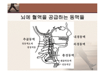 뇌졸중의 이해 레포트-12