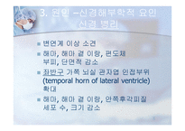 조현병 schizophrenia-10
