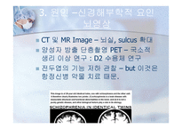 조현병 schizophrenia-12