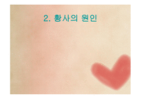 중국의 대기오염 문제 황사黃沙-4