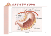 소화성궤양 레포트-6