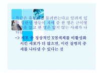 X염색체의 비밀-15