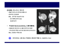 가장 뛰어난 뇌의 조건-13