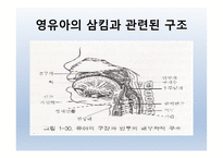 Dysphagia(연하곤란)-9