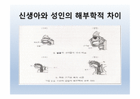 Dysphagia(연하곤란)-10