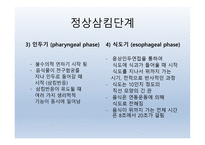 Dysphagia(연하곤란)-19