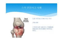스키 안전사고, 사고 예방법-3