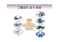 고혈압의 증상과 치료 발표자료-5