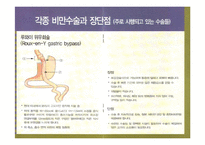 고도비만수술(베리아트릭 수술)-5