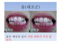 치약의 종류에 따른 치아 살균효과 및 PH측정 -19