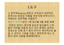 목   탄의 역사, 종류 -11