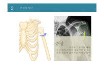 신체 부위별 골절의 치료와 간호 -3
