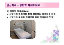 피부질환의 치료적접근 -8