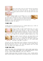 여드름에 관하여 -5